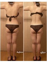 アンフィニ(infini)/全身短期集中コース5回（2ヶ月)