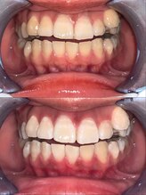 ライトビューティー 池袋店(LightBeauty)/症例写真