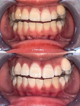 ライトビューティー 池袋店(LightBeauty)/症例写真