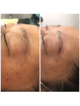 美髪しゅぷうる 瑞江/眉毛ブロウリフト＆wax