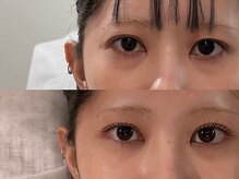 アオフクオカ(ao. Fukuoka)/まつげパーマ