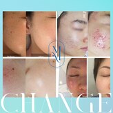 マインエム(mine.m)