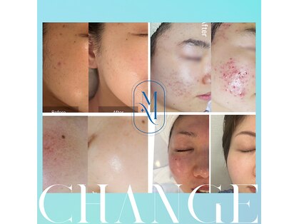 マインエム(mine.m)の写真