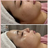 エーエフビューティーエステ(AF Beauty Esthetic)