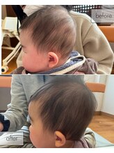 しん整骨院/子どもの頭の形