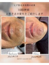オフ(off)/ヒゲ脱毛