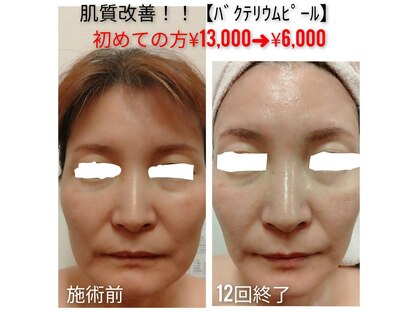 ハナノ 川越店(Hanano)の写真
