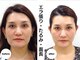 グランルーツ 可児院(GranRoots)の写真