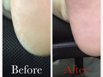 【ネイル】フット角質ケアコース