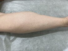 ナノハナ/鹿沼市全身脱毛美容室ナノハナ