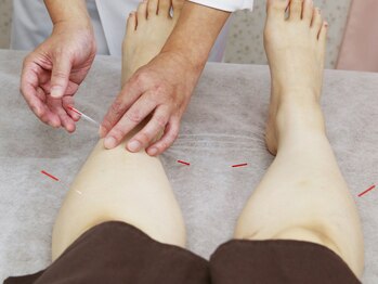 しろくま鍼灸院/国家試験保有者