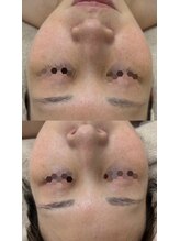 スペース(spAce)/美肌×小顔×リラクゼーション