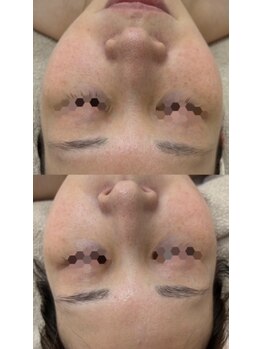 スペース(spAce)/美肌×小顔×リラクゼーション