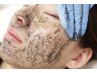 【エステ人気】”毛穴悩み、ニキビケア”ハーブピーリング