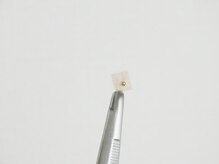 マンツーマンサポート◎結果重視の方おすすめ！痩身/ダイエット