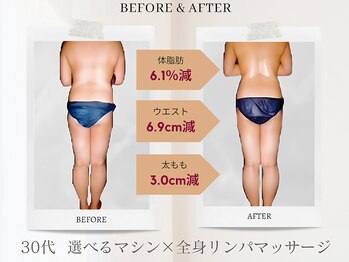 プレステージ 川崎店/マッサージ◆ビフォーアフター