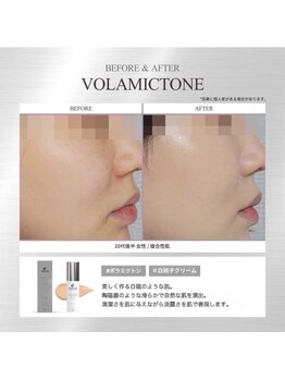 ペイジ(peige)/【peige】商品