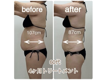 アミクール エステティックサロン(amicoeur)の写真