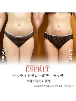 エスプリ 新宿店/お腹スリム・痩身エステ新宿