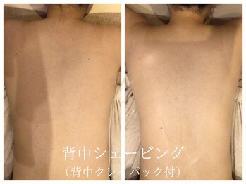 リノ(Lino)/背中シェービング◎