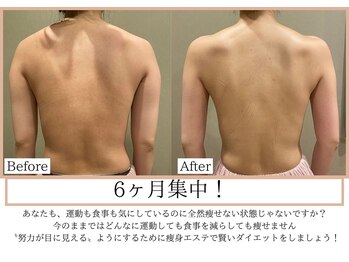 エス シークレット 金町店(S secret)の写真/スピード痩身!SNSで話題のスリムムーヴが3300円◇温め+ほぐし+吸上げで滝汗&脂肪撃退!