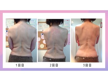 バランスアップラボ(バランスアップLAB)の写真/【 見た目-5kg級！？ 】塗って整えるだけでくびれ美人に