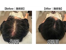 BLD/ビフォーアフター