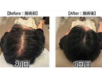BLD/ビフォーアフター