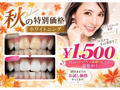 ホワイトニングショップ 秋田店の写真