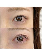 フランセス(Frances)/上下ラッシュリフト