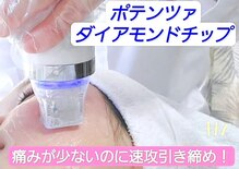 パイナップルピース(Pineapple Peace)