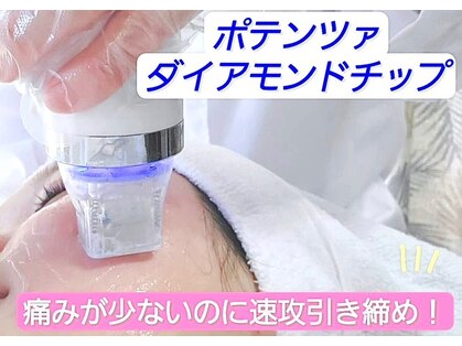 パイナップルピース(Pineapple Peace)の写真