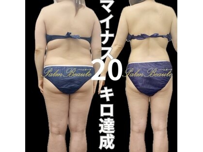 パームボーテ(Palm Beaute)の写真