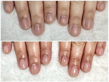 グラシナ 鳥丸店/乾燥で爪が割れてしまうなら