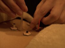 ルーロ サロン(LooLo salon)の雰囲気（肩こり／腰痛や自律神経の乱れは鍼灸施術で解消。専門講師監修◎）