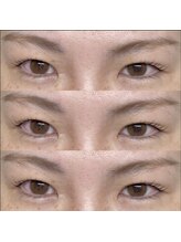 マツエク カハナ 北千住(Kahana)/【まつげパーマ】シェル