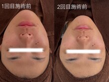 テンニック(10nick)/透明感あるお肌に