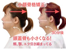 エンジェル(Angel)の雰囲気(即実感きれいに可愛く【小顔骨格矯正】¥7800)