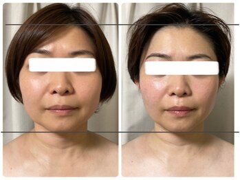 スリーピングビューティー(Sleeping Beauty)/