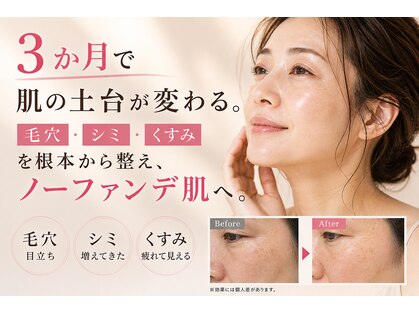 ウララ(ulala)の写真