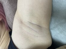 ナノハナ/鹿沼市全身脱毛美容室ナノハナ