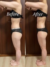 ヴィム(VIM)/ハイパーナイフビフォーアフター