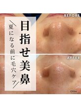 オリオンドットエスツー(Orion.S2)/【Before→After】