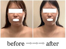 スラン(Slan)/輪郭チェンジ★