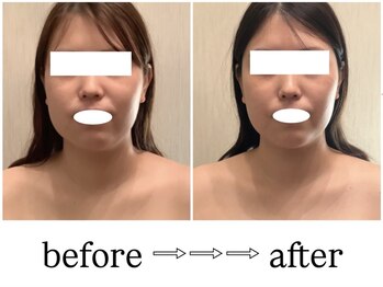 スラン(Slan)/輪郭チェンジ★