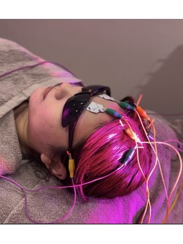 ミプラス鍼灸スタジオ/【美髪鍼】LED近赤外線