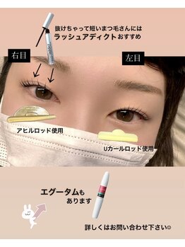 シュピネ(Choupinet)/◯美容液正規取扱店◯