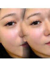 ジュベアイラッシュ(juve. eyelash)/Extension