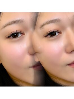 ジュベアイラッシュ(juve. eyelash)/Extension