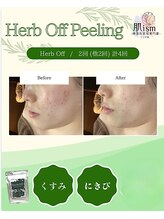 肌イズム つくば店(肌ism)/フェイシャルビフォーアフター